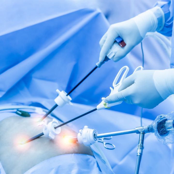 Ginecologia Oncológica e Cirurgia Minimamente Invasiva