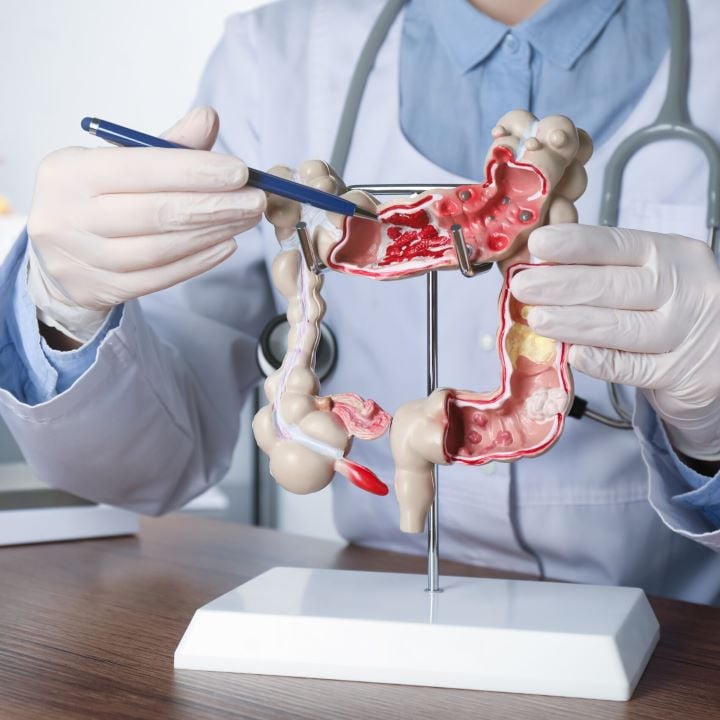 Coloproctologia