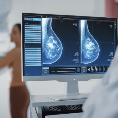 VII Oncologia do Câncer de Mama