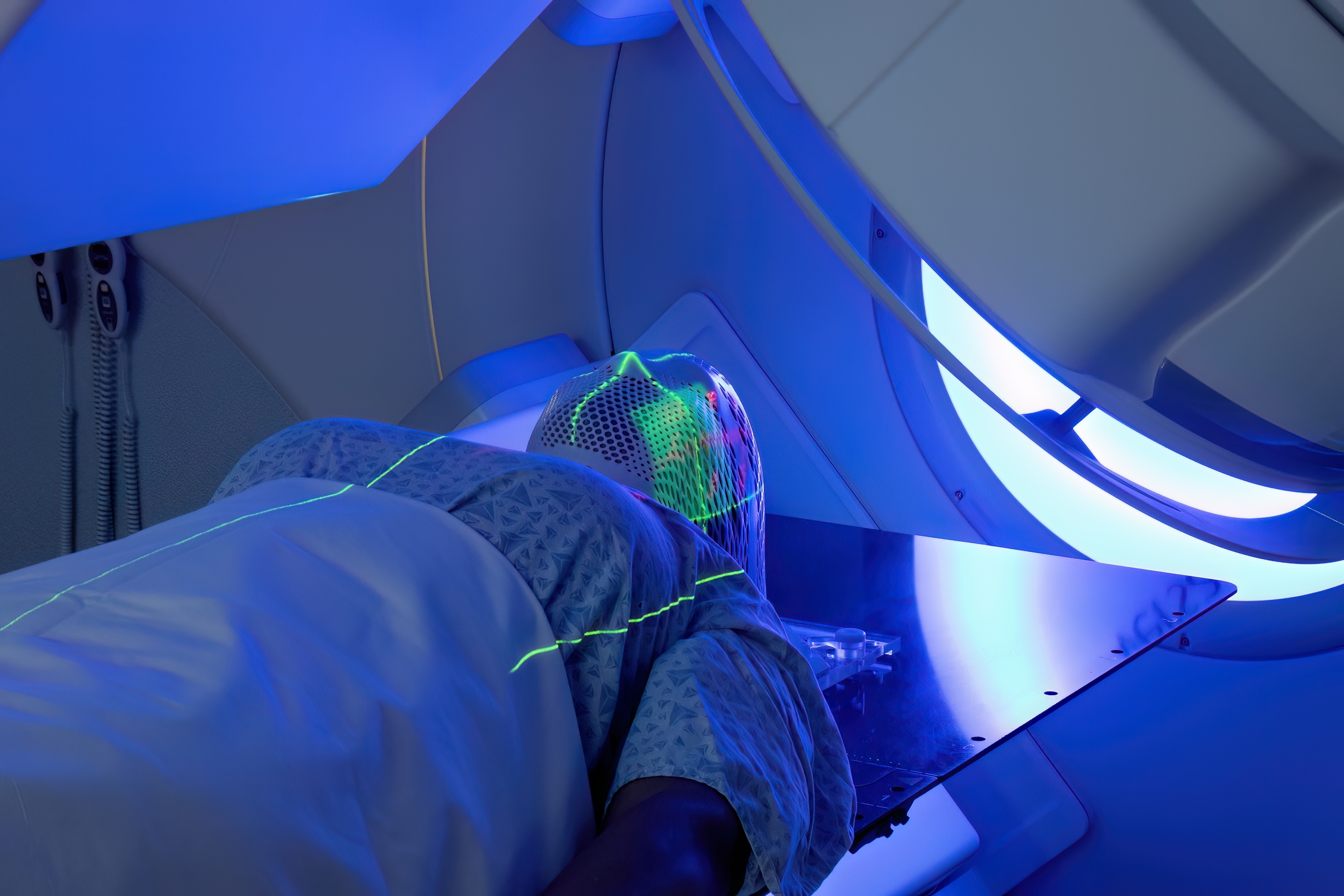 Radioterapia