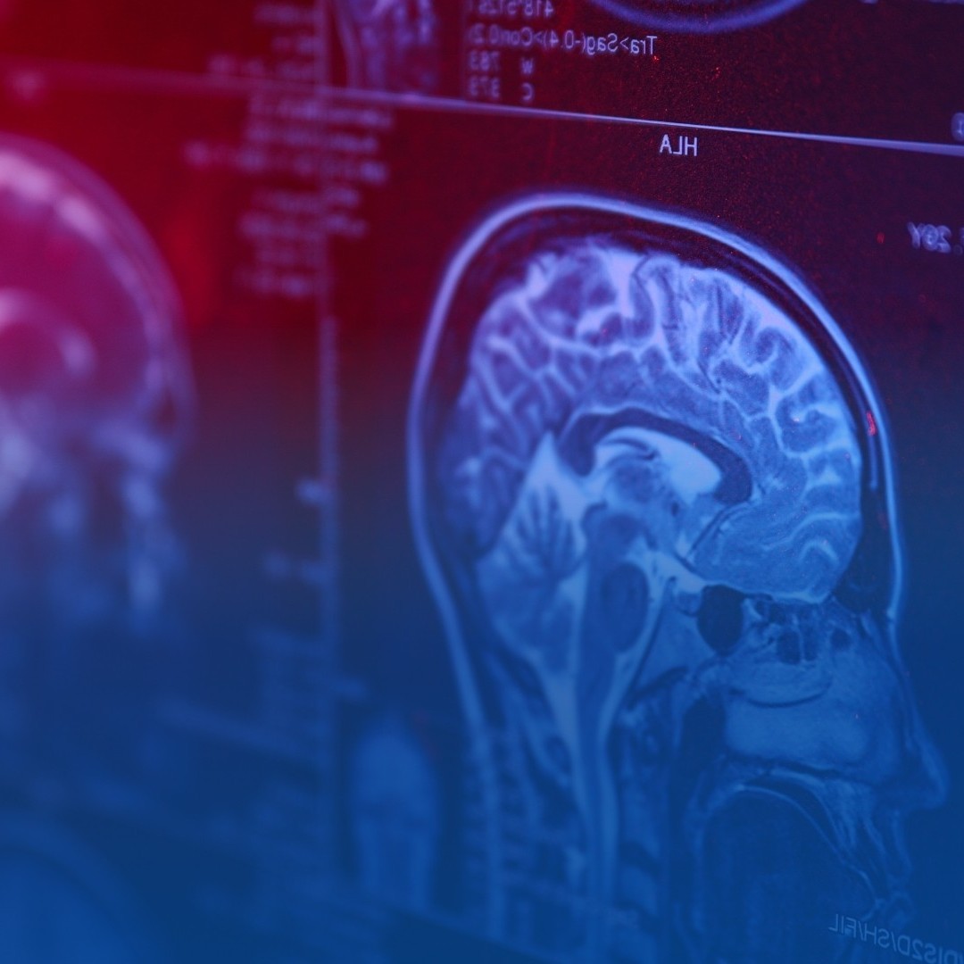 SIMPÓSIO MANEJO DE METÁSTASES CEREBRAIS [11/10/2025]